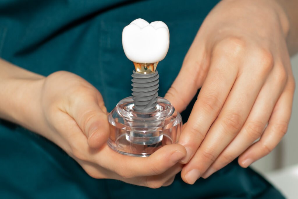 Dental Implants: The Permanent Solution for Missing Teeth
